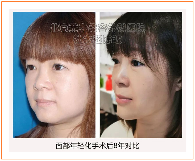 这么低价的拉皮，您做的是真的吗？