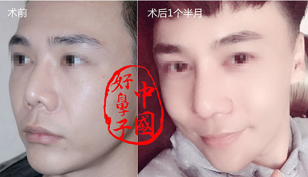 鼻修复者都面临了哪些困难？