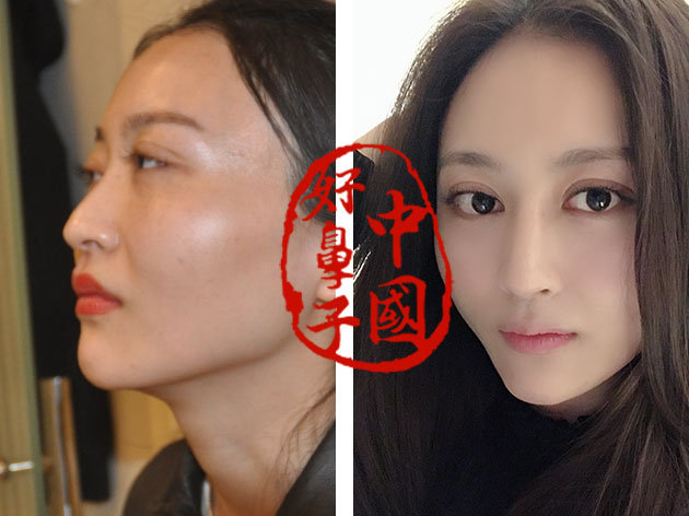 鼻子要求垫多高才算美呢?