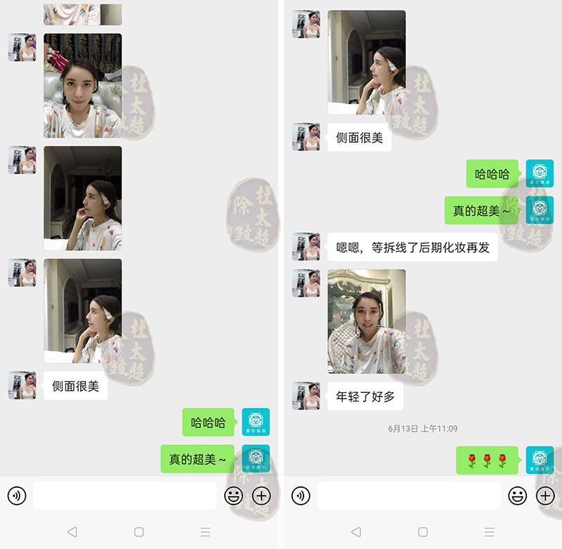 抗衰项目琳琅满目，到底谁才是心头好？