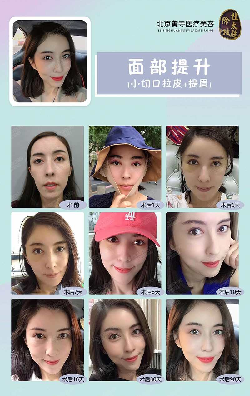 抗衰项目琳琅满目，到底谁才是心头好？