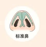 大鼻头缩小如何做？ 