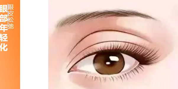 我才这么年轻，怎么眼皮都松弛了
