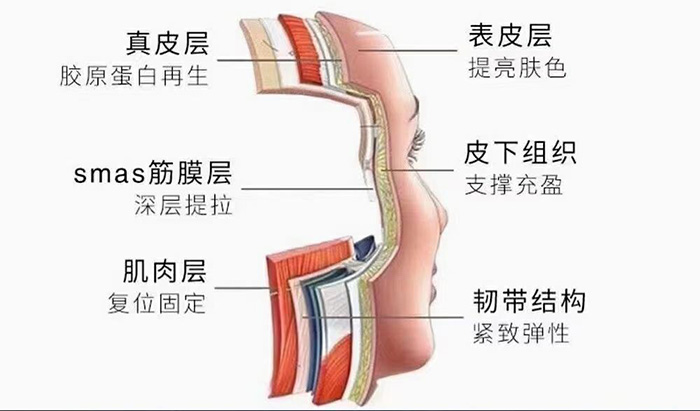 小切口提升真的需要祛那么多皮吗？