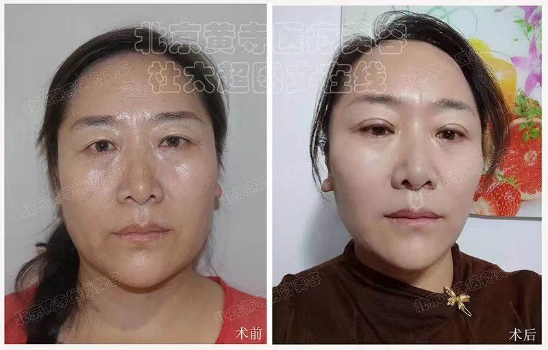 与时间赛跑的女人，用“小切口提升”助跑？