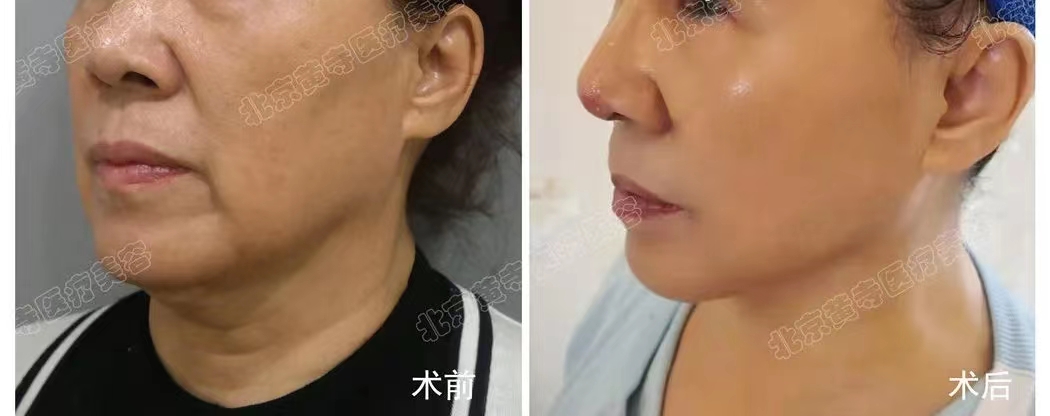 抗衰提升的误区，您知道吗？