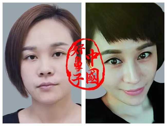 露鼻孔该怎么做？