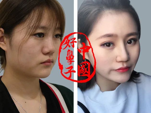 自然好看、能摸能动不惧揉捏的“中国好鼻子”！