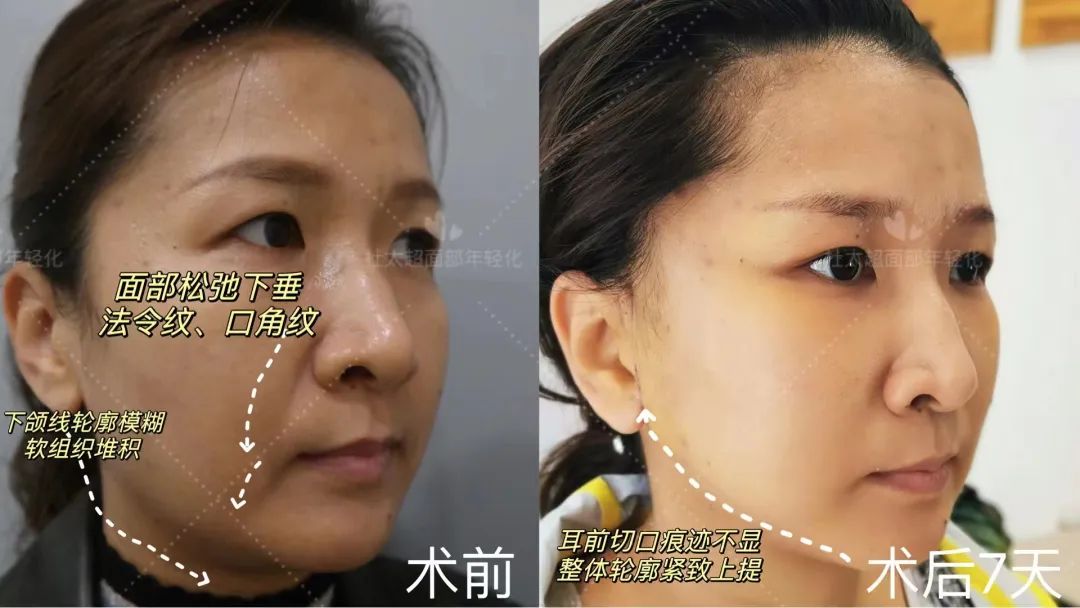 关于衰老我有话说...