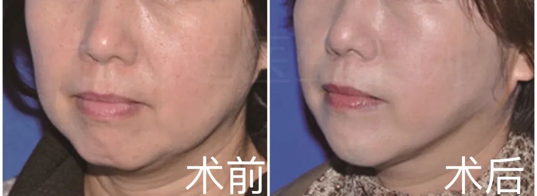 年轻几岁你说了算...