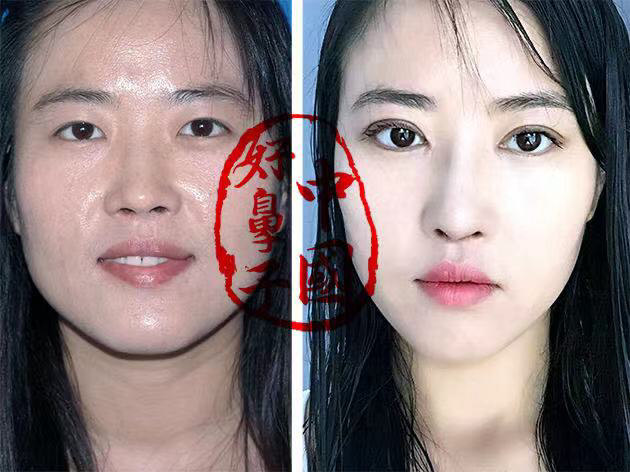 你渴望拥有秀气的鼻子吗？