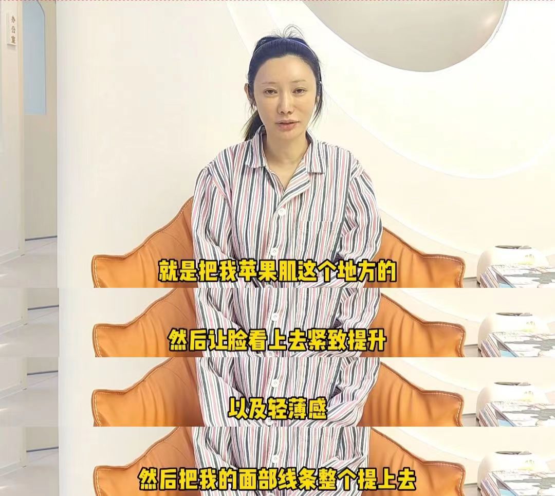 39岁求美者追求面部年轻感，公开术后效果