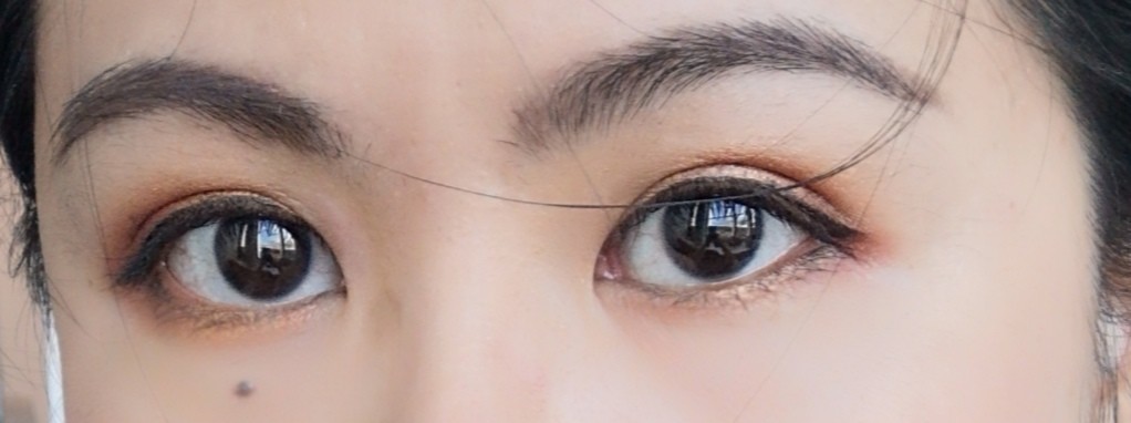 做完切眉术后10天，分享真实术后恢复过程