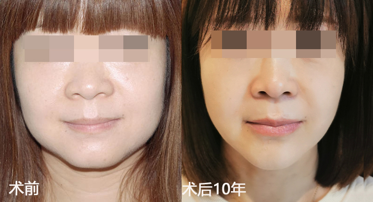 49岁还不如52岁的闺蜜年轻，只因她做了……