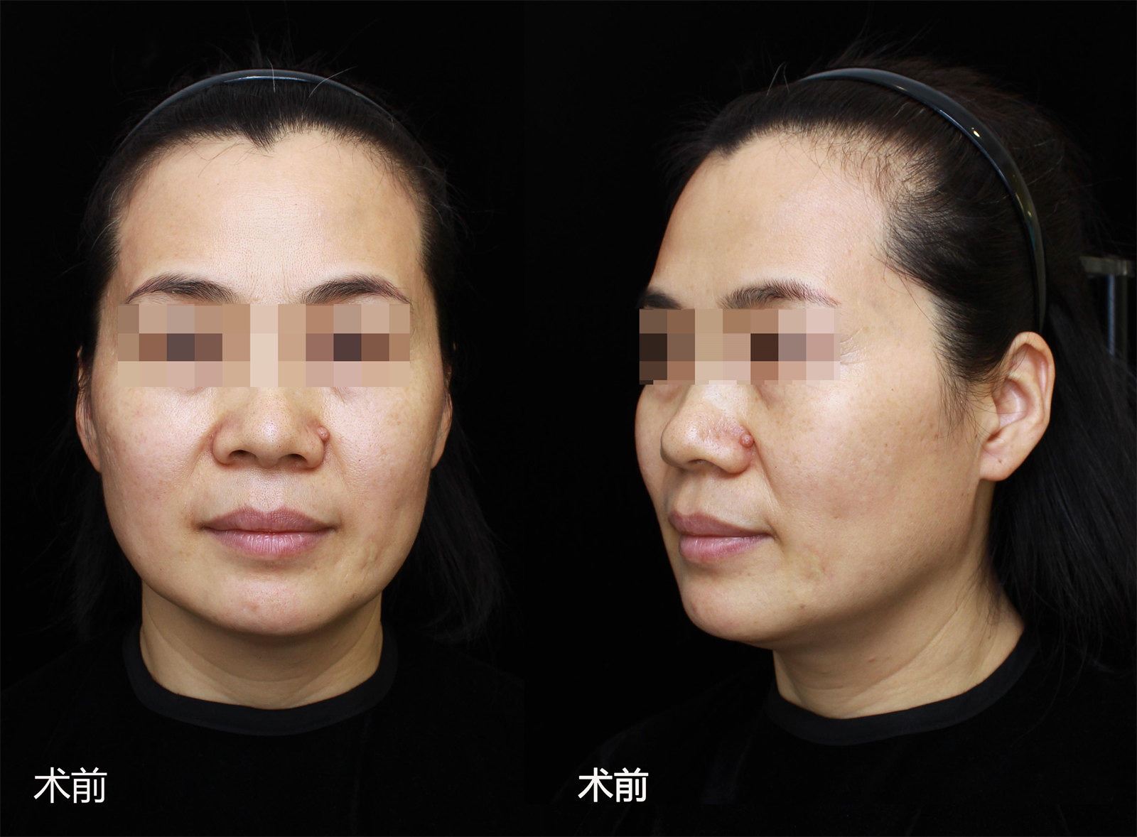 49岁还不如52岁的闺蜜年轻，只因她做了……