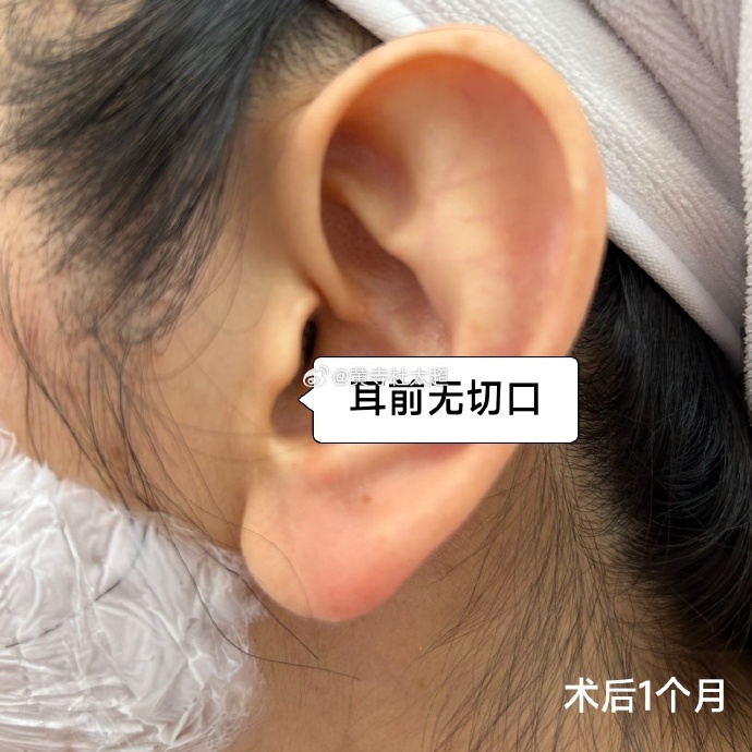 aac18d2cd76d1cfbd32477eba7610e26_6119e850ly1hg15hz91i1j20zi0zialc.jpg