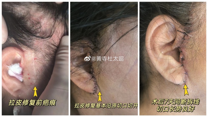 b2f21430bd3563458365a93445f248b6_6119e850ly1hdvfzs4butj235s1s0u0x.jpg
