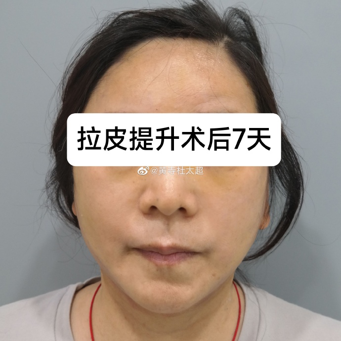 755ecdd86cce03e8994e90647affef9f_6119e850ly1hdmc6wjzzbj226n26nhdt.jpg