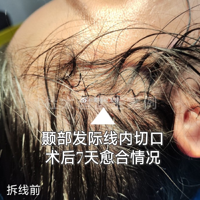 f54d69e7b2cc52715edc3a1ea54f9324_6119e850ly1hdl7hle8hxj20zk0zktnu.jpg