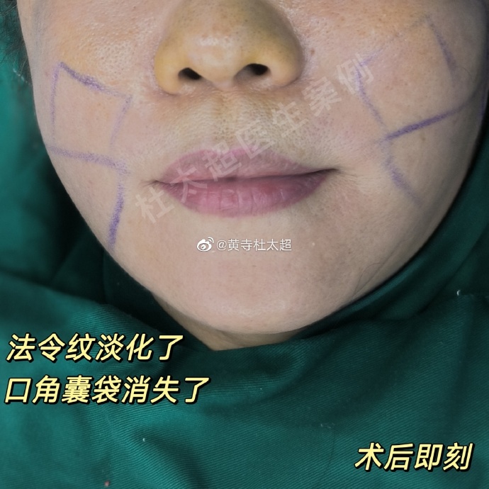 9c7da000df0c229d784b5b7699c1b00c_6119e850ly1hao4dhxx7bj20zk0zk140.jpg