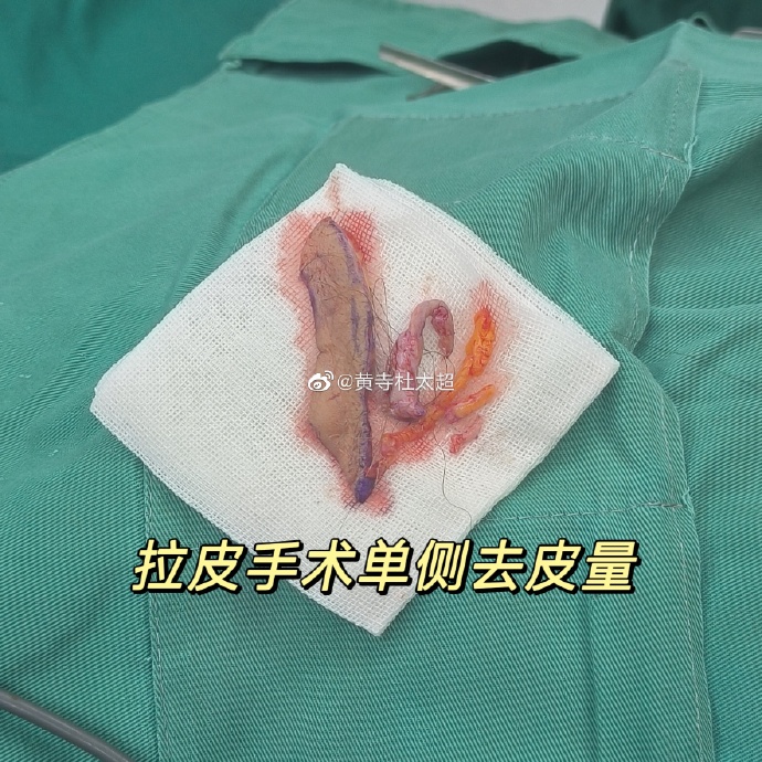 cb0a485e5a8b48fcb26dcb9ad4ce81ec_6119e850ly1hao4esgcrzj21d61d64qp.jpg