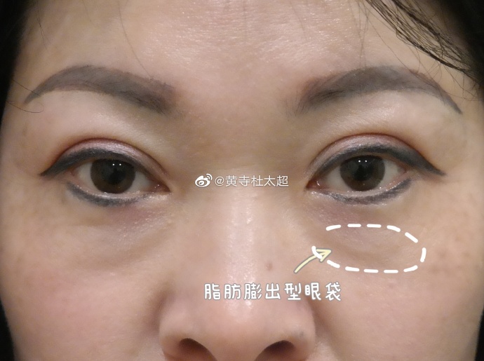 97623d7c93e529ccdd09474bc3bbb39b_6119e850ly1h9ynuhe2hbj212x0t211z.jpg