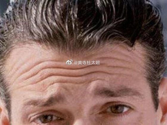 ffda42602f4f71ad9d38c3c6797f56b2_6119e850ly1h9tprbe0iyj20fl0bp75z.jpg