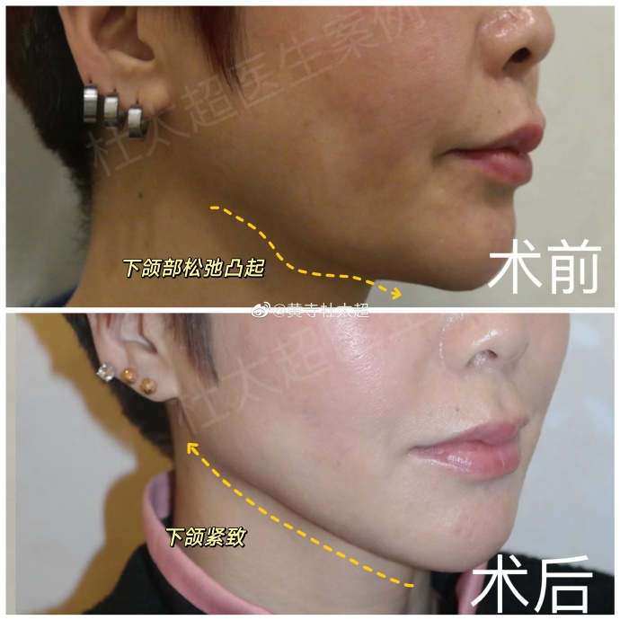 77a237a7cd27e58e539535a4cb963e3d_6119e850ly1h9qgmy0u5vj235s35s1ky.jpg