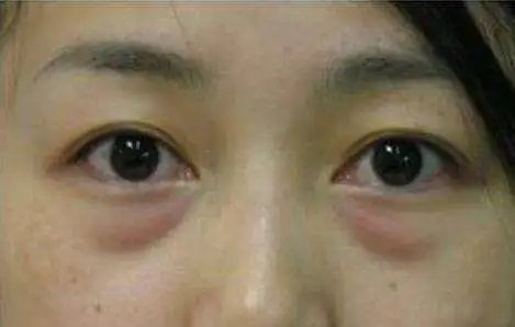 a51a7297d53aa43b0cc84e2a33c8f402_848eb71f6eeb96c570bc58e0a86d36be.jpg