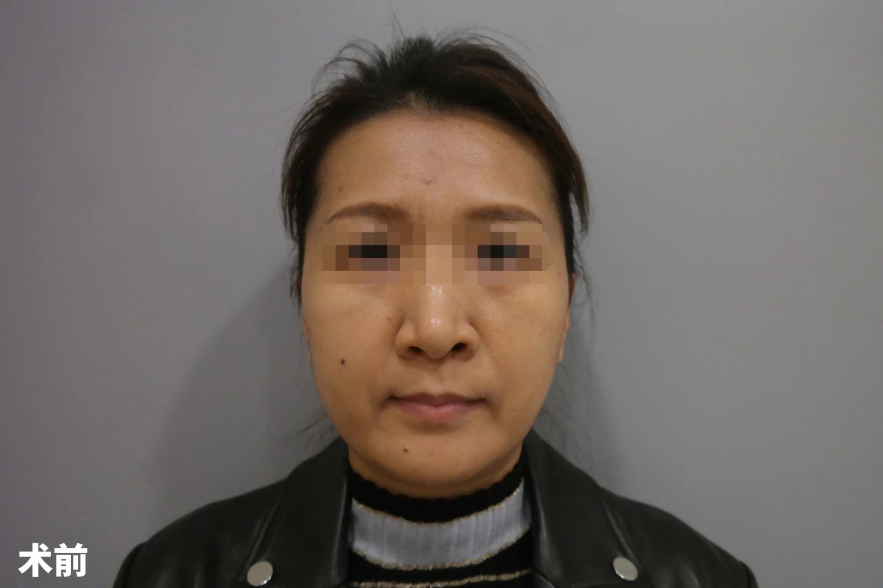 回眸手术前那些担惊受怕的日子，不禁哑然失笑，原来一切都是多余的担忧，真的就是“白担心一场”！