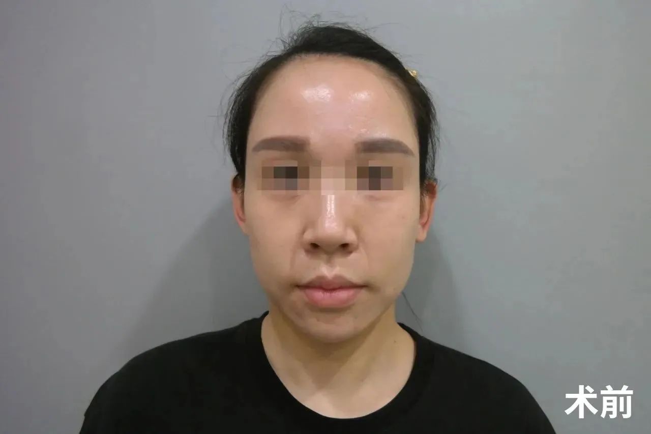 所有的坚持与付出都是值得的，因为我找回了那久违的自信和美丽。