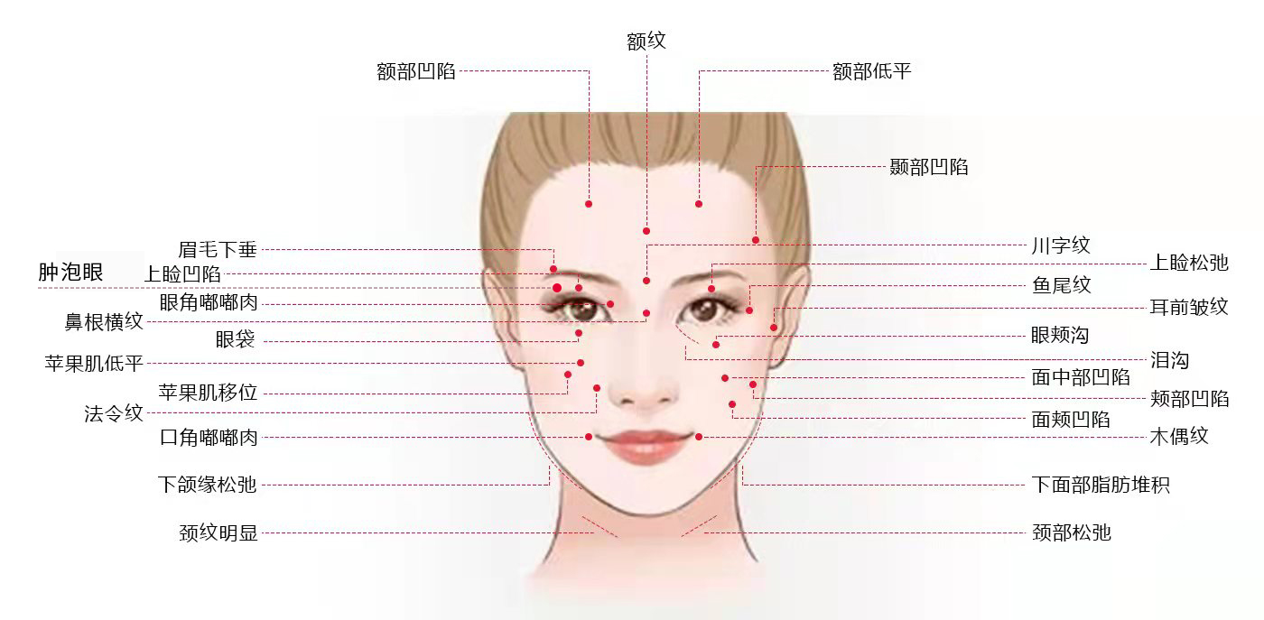 一篇文章，带你了解什么是caw小切口面部提升术？