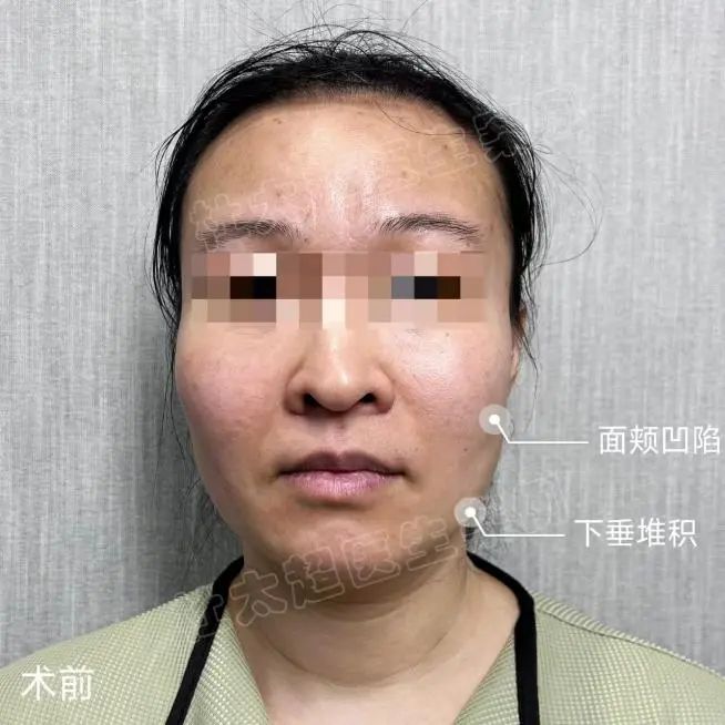 我不希望改变太大，我害怕别人的嘲笑！