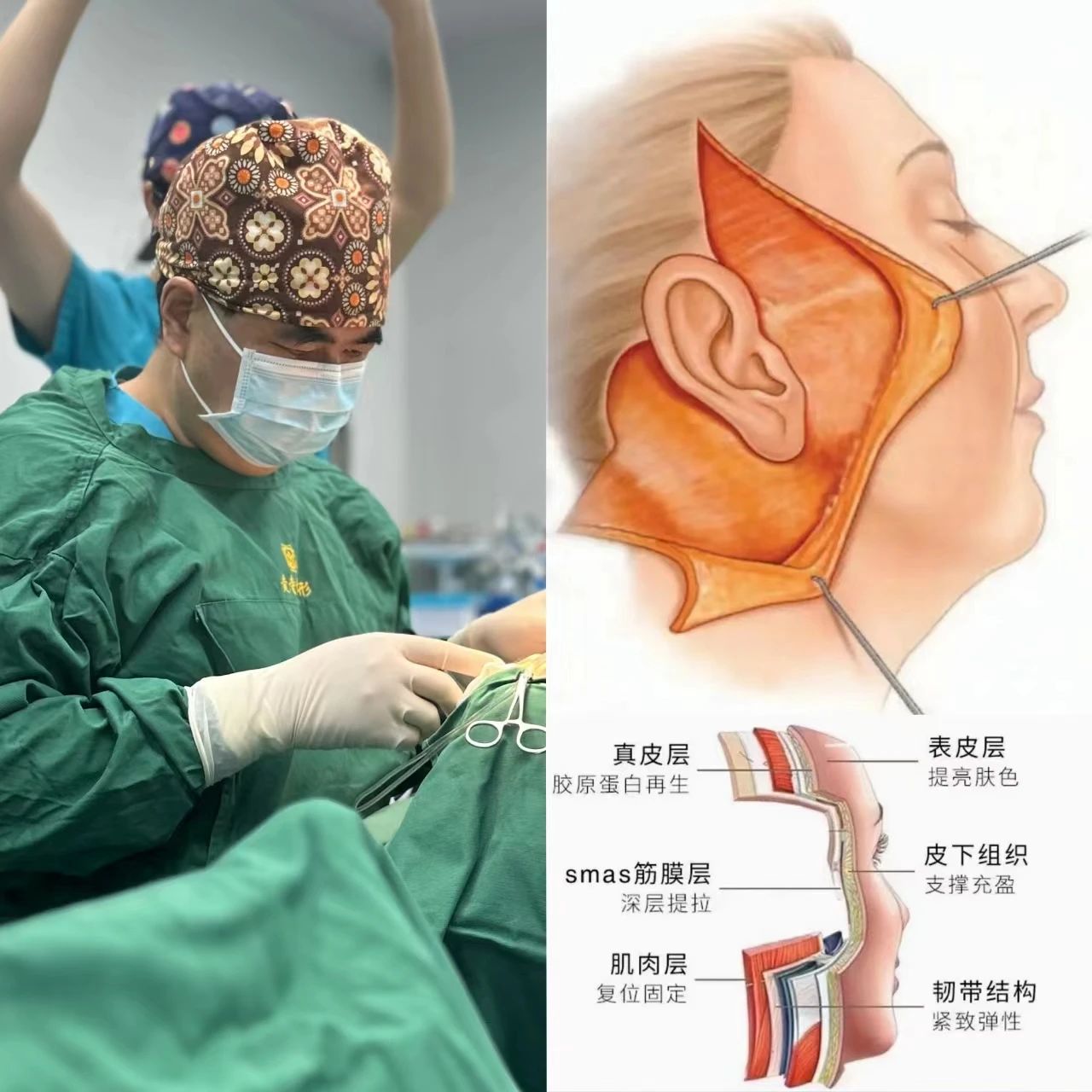 拉皮手术后留下蜈蚣样的疤痕怎么办？