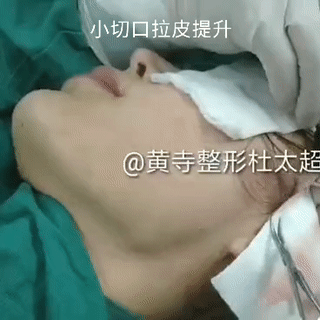 瘦了以后皮肤松弛怎么办？