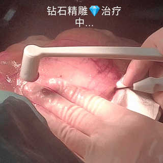 瘦了以后皮肤松弛怎么办？