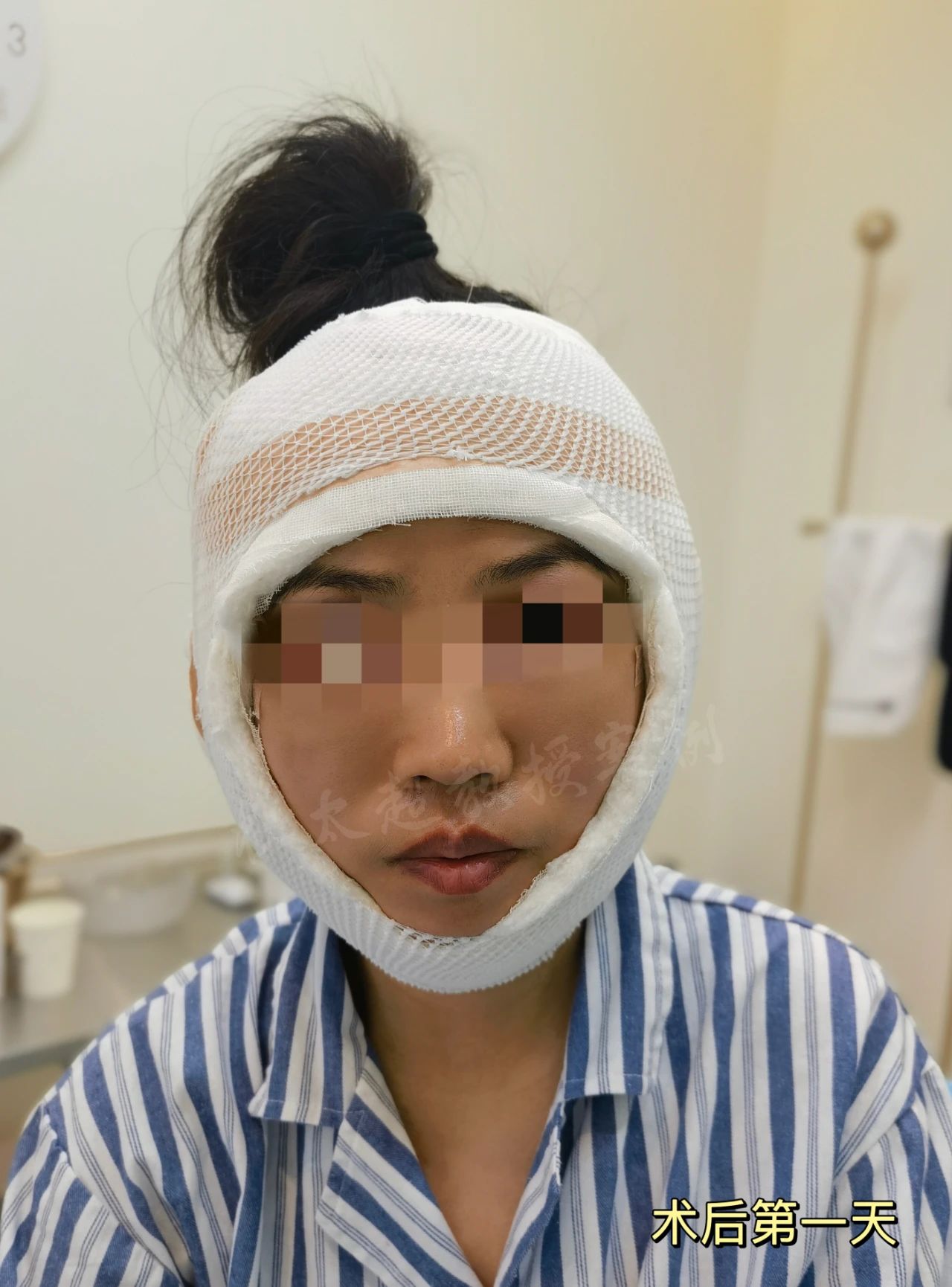 她说太丑！拉皮手术到底给她带来了什么，想要惊艳时光是痴心妄想？