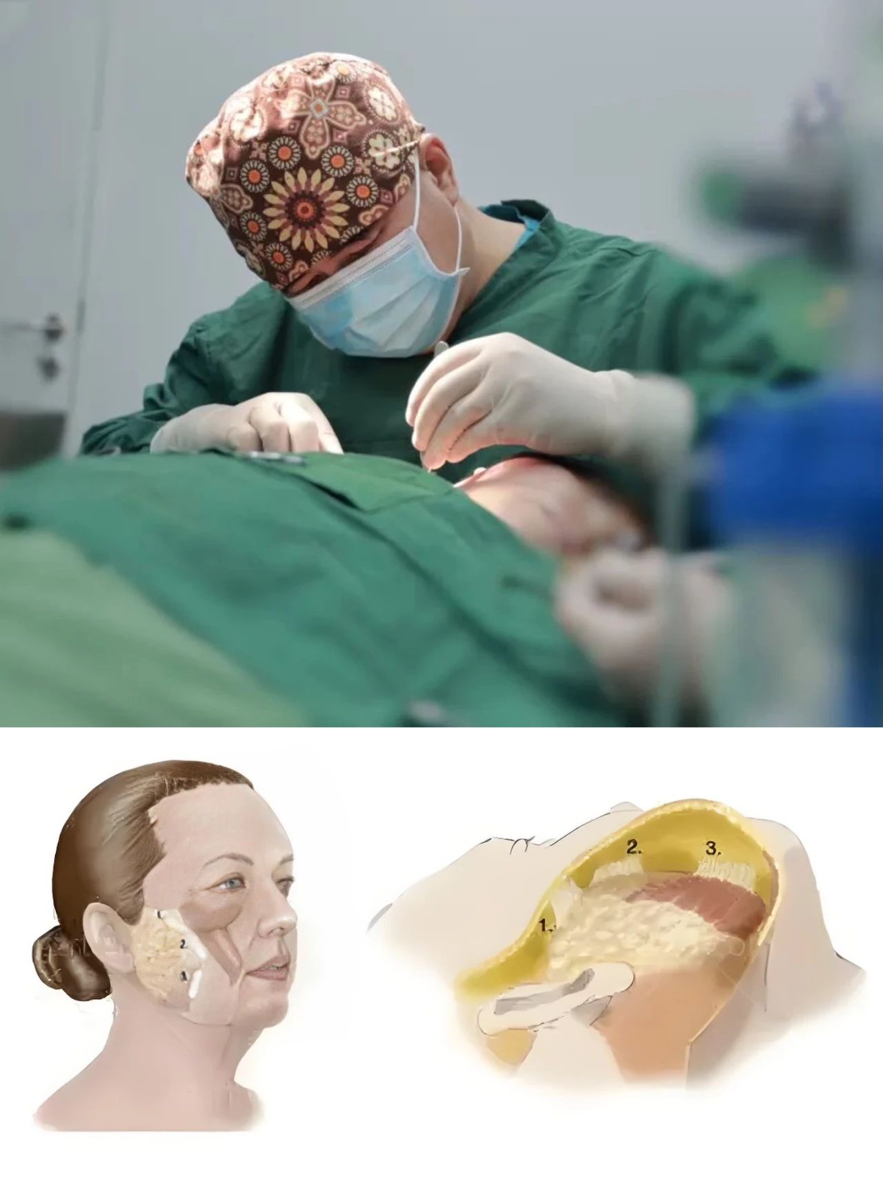 拉皮手术哪里做的最好?