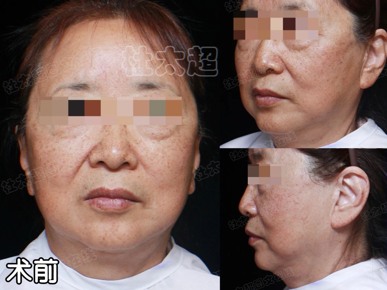 皱纹背后的故事：66岁，我选择做最好的自己！