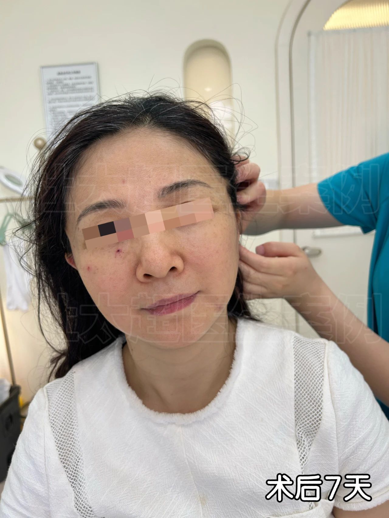 她们笑我越老越“妖”！我50岁做了拉皮手术，老公更爱了，她们都嫉妒了！