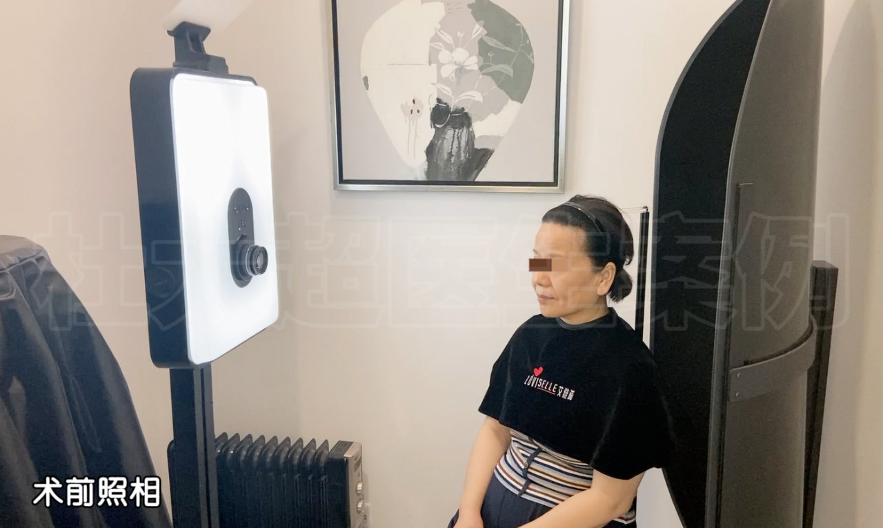 这样的效果你说差？49岁大姐携手47岁小妹一起做拉皮手术，术后效果让人不敢相信！