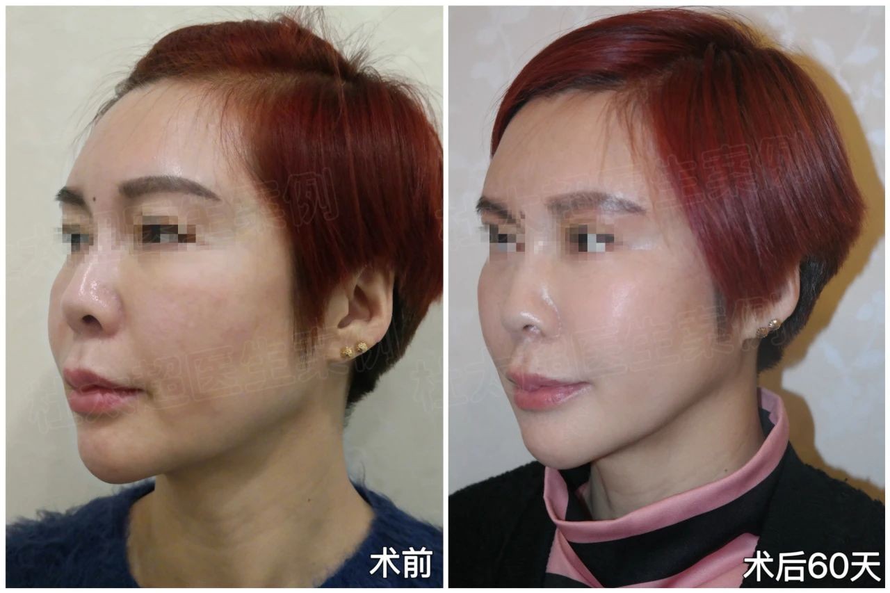 微信图片_20250211085045.jpg