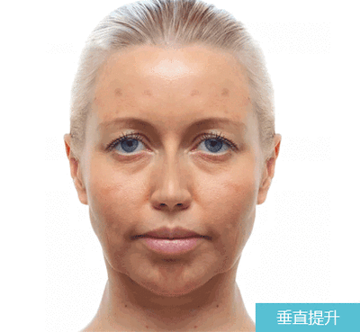 微信图片_20250306094637.gif