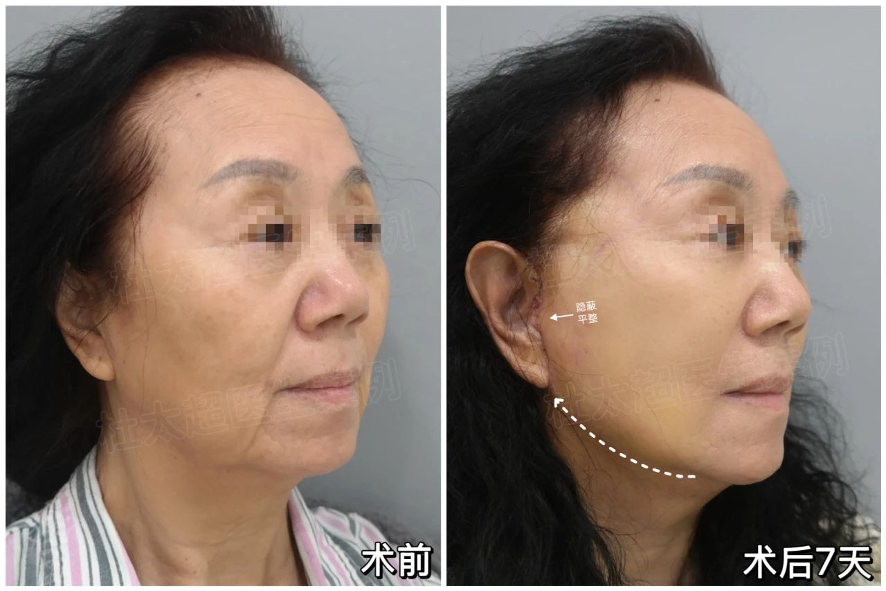 微信图片_20250314185846.jpg